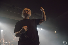 IMG_7629-severe-noise