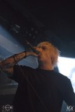 IMG_7637-severe-noise