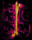 FemurII