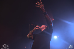 IMG_7297-severe-noise